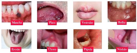 Estomatologia Diagn Stico Das Doen As Bucais