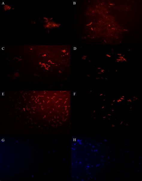 Fluorescence In Situ Hybridization Fish Results Of Anaerobic