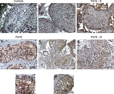 Immunohistochemistry Staining Of Prostate And Testis Expression Pate