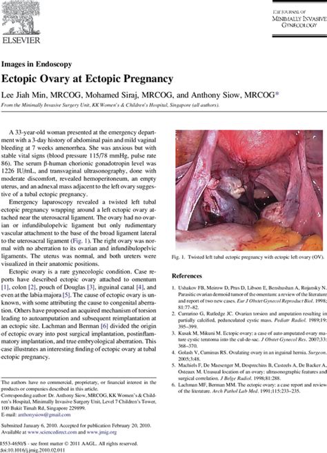 Ectopic Ovary At Ectopic Pregnancy Journal Of Minimally Invasive