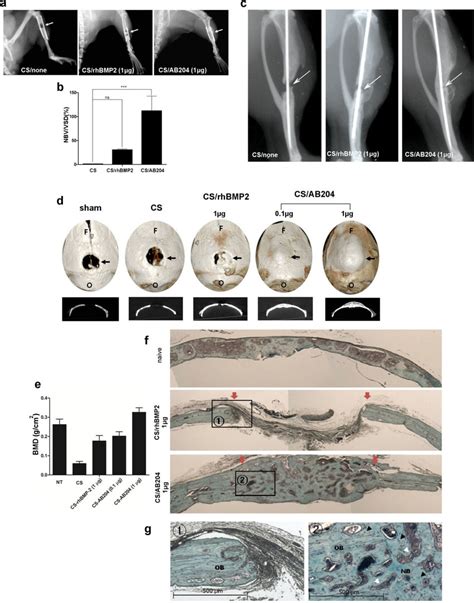 AB204 Excels In Inducing Orthotopic Bone Formation In Critical Size