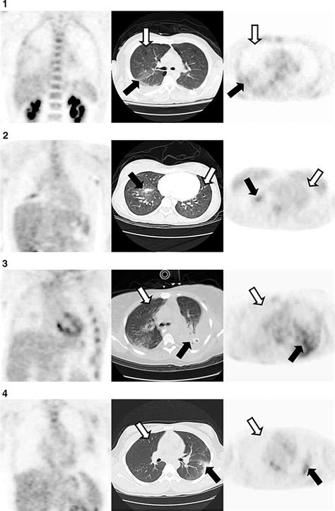 Frontiers Metabolic Imaging And Biological Assessment Platforms To