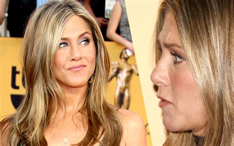 Jen Aniston's Surgery Secrets — She Gets Botox & Fillers, Docs Say