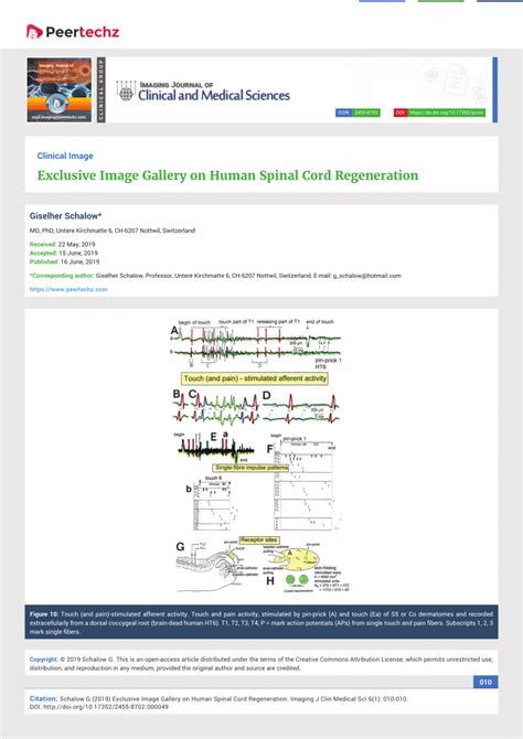 (PDF) Exclusive Image Gallery on Human Spinal Cord Regeneration ...