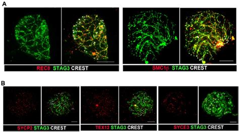 Sc Proteins But Not Cohesin Proteins Are Lost From The Chromosome