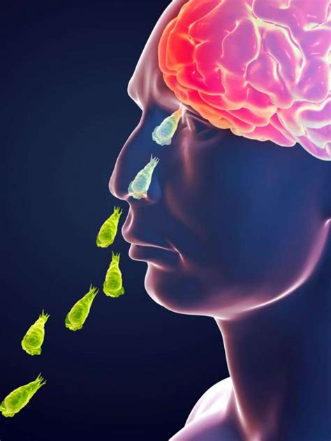 Brain Eating Amoeba What Happens After It Enters Your Body Onlymyhealth