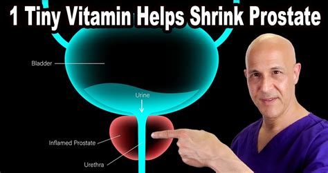 1 Tiny Vitamin Helps Shrink Your Enlarged Prostate