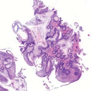 A B H E Stained Sections Of Colon Mucosal Tissue Showing A Pattern