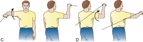 Throwers’ Ten Exercise Program | Musculoskeletal Key