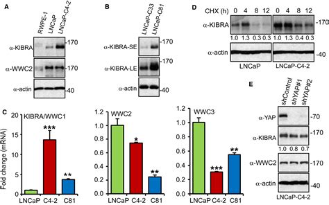 Kibra Promotes Prostate Cancer Cell Proliferation And Motility