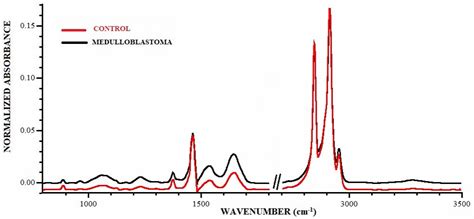 Molecules Free Full Text Infrared Spectroscopy As A Potential Diagnostic Tool For