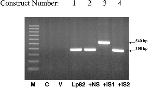 Ethidium Bromide Stained Agarose Gels Showing Results Of Rt Pcr Using