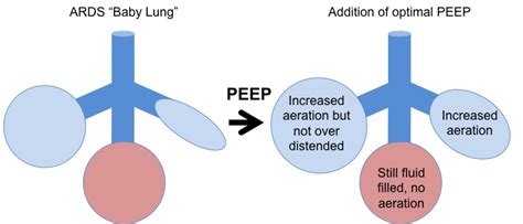 David Furfaro On Twitter 8 With PEEP We Add Another Element Using