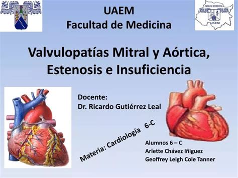 PPT Valvulopatías Mitral y Aórtica Estenosis e Insuficiencia