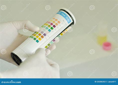 De Analyse Van De Urine Stock Afbeelding Image Of Gezondheid 25306353