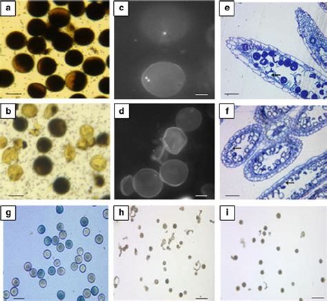 Phenotypic Analysis Of Pollen From Wt And Transgenic Plants A I 2