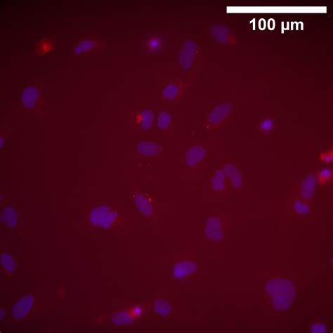 Addgene Antibody Data Hub Anti Gfap N A R In