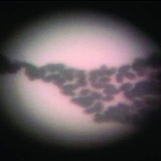 Microscopic observation of Leuconostoc. | Download Scientific Diagram