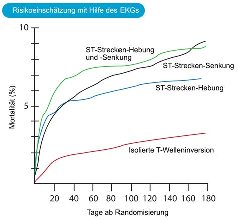 Diagnosekriterien Des Akuten Myokardinfarkts Herztroponine EKG