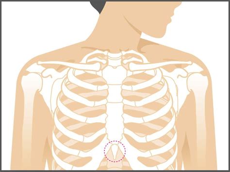 Xiphoid Process Lump Symptoms