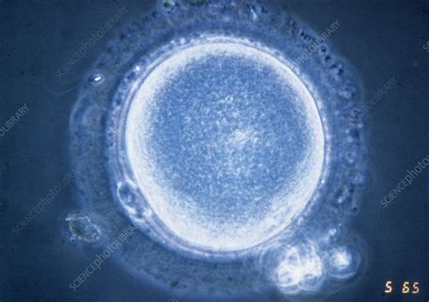 LM Of Mature Human Oocyte Metaphase I Stage Stock Image P632 0016