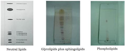 Thin Layer Chromatography Tlc Microbiology