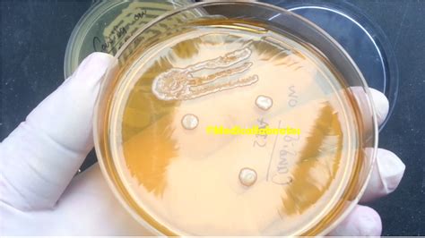 Candida glabrata: Introduction, Morphology, Pathogenicity, Lab