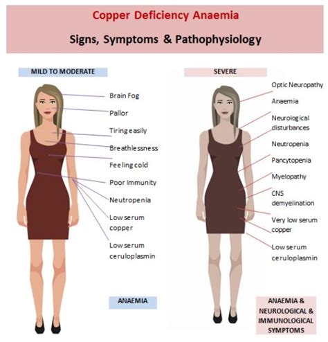 Copper Deficiency Signs And Symptoms At Lauracshort Blog