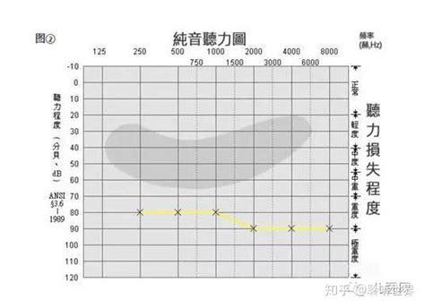 如何看懂听力图 知乎