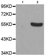 Anti Tyrosine Hydroxylase Phospho S31 Antibody Ab194760 Abcam