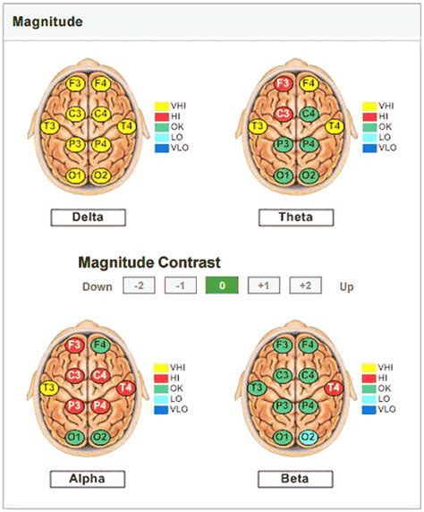 Understanding Your Neurofeedback Report The Brain Wave Center