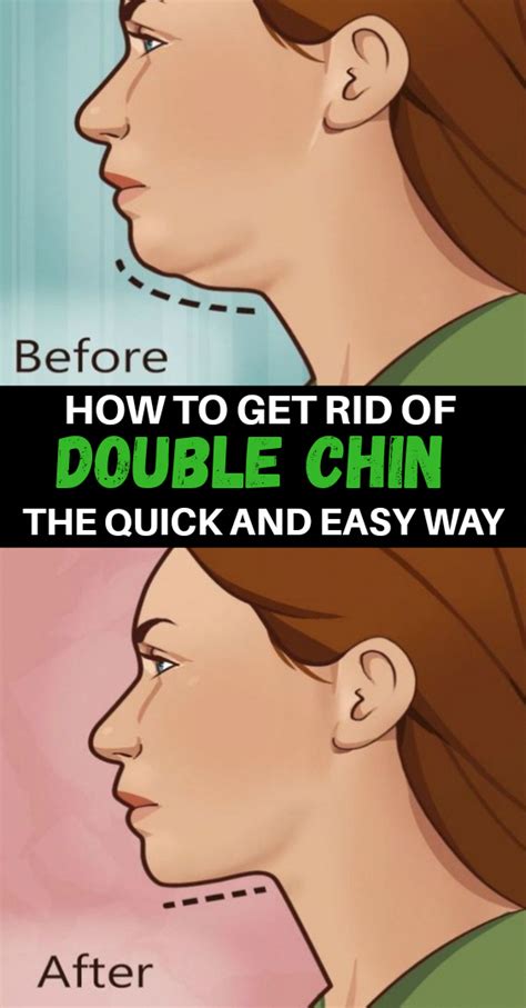 5 Exercises To Avoid Stubborn Double Chin Chin Exercises Double Chin