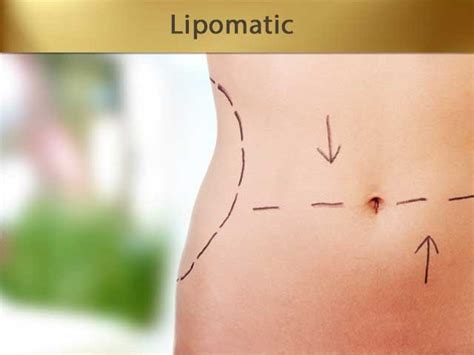 What Is Lipomatic Turkey Istanbul Medical