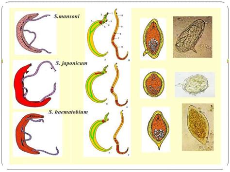 Ppt Schistosomiasis