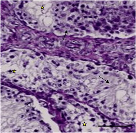 Light Micrograph Of Section In The Testicular Tissues Of Tio