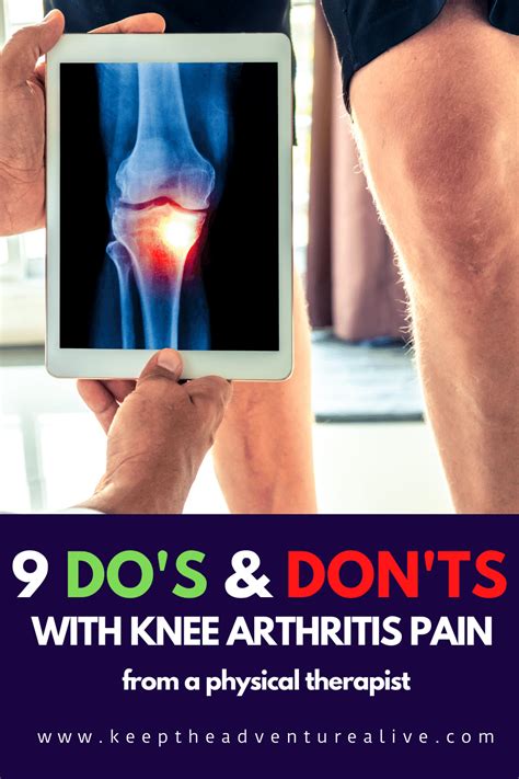 Arthritis knee pain – Artofit