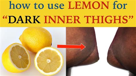 5 Ways On How To Use Lemon To Get Rid Of Dark Inner Thighs Home