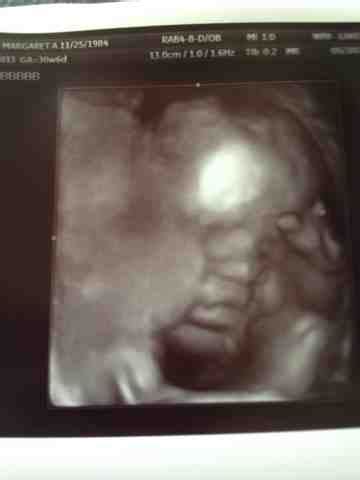 Twin Parenting: Good appointment today! 3D ultrasound pics