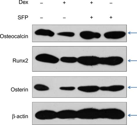 Effects Of Dexamethasone Dex And Sulforaphane Sfp On The Expression