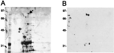 2d Western Blot Analysis Of Hplc Fraction 38 Fraction 38 Was Separated