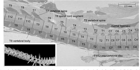 Figure 4 From Vertebral Landmarks For The Identification Of Spinal Cord Segments In The Mouse