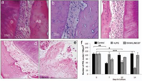 Figure From A Novel Ex Vivo Culture Model For Inflammatory Bone