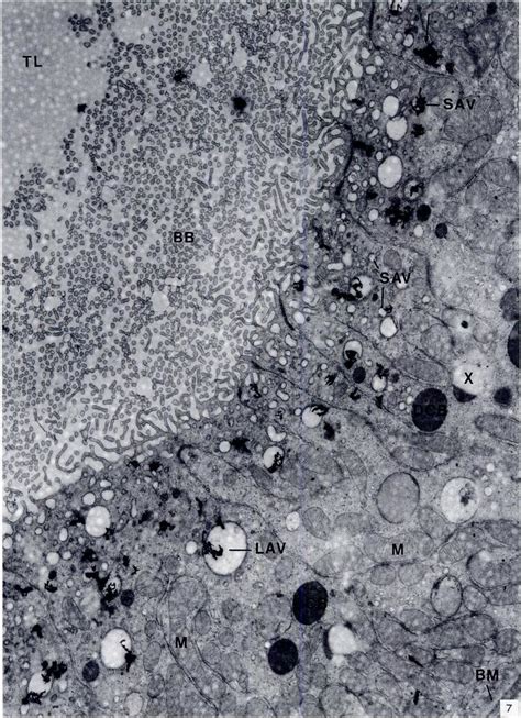 Electron Microscopic Autoradiograph Of Proximal Tubule Cells Fixed