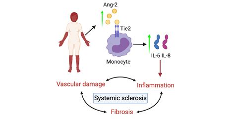 Ijms Free Full Text Angiopoietin 2 Promotes Inflammatory Activation In Monocytes Of Systemic