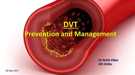 Dvt Prophylaxis In Orthopaedics Ppt