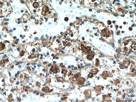 Cd206 Antibody 60143 1 Ig Proteintech