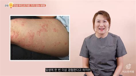 두드러기 만성으로 가지 않으려면 이것만은 절대 하지 마세요 Ft 허리 시술 받다가 두드러기 생긴 썰 이소한의원