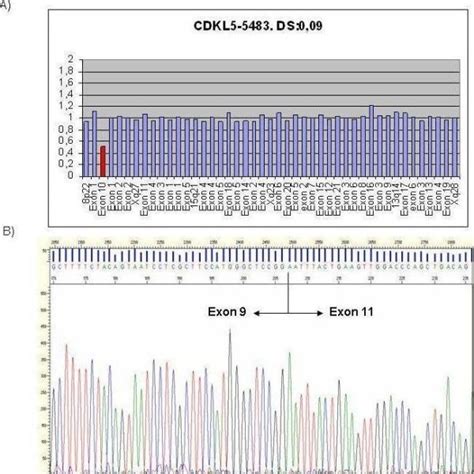 Complete Deletion Of Exon Detected By Mlpa A And Confirmed By Cdna