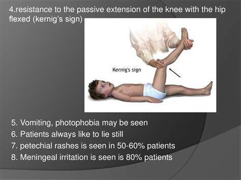 Bacterial Meningitis Ppt Download