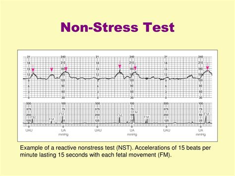 Ppt Fetal Well Being And Electronic Fetal Monitoring Powerpoint Presentation Id 1091518